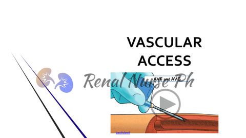 Avf throughout Beyond the Basics Understanding the AVF Varano's Features