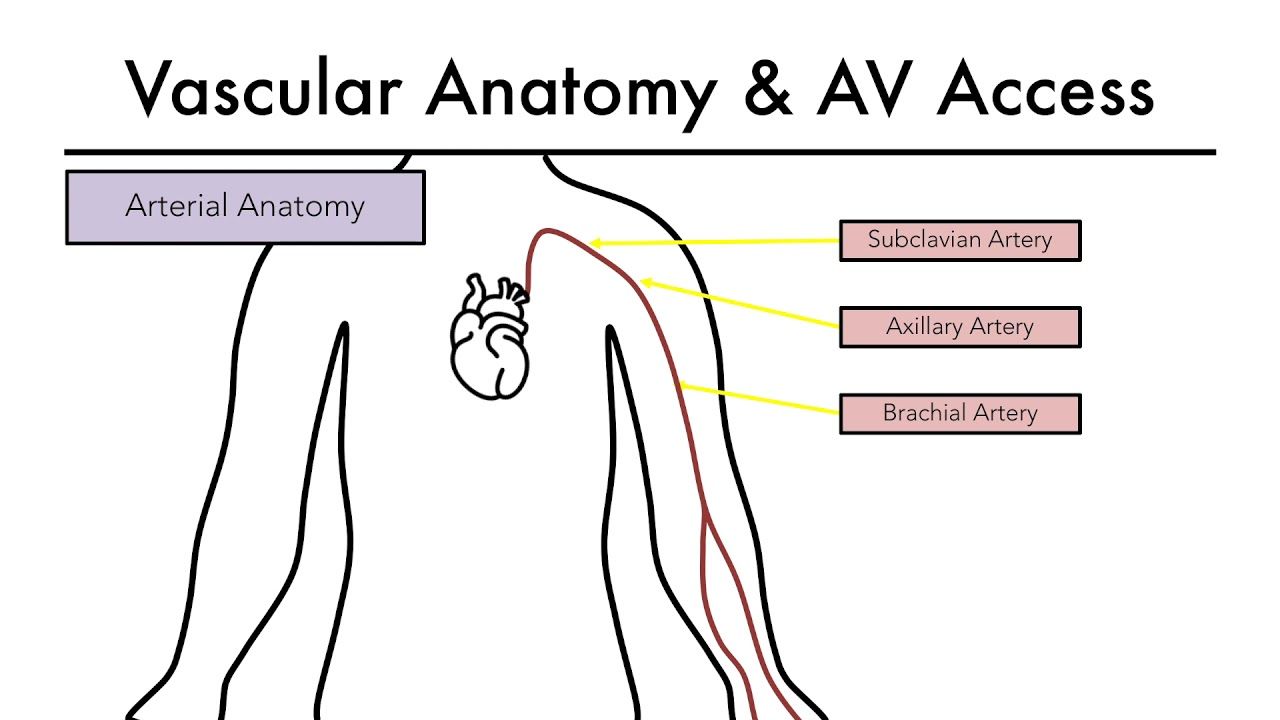 Hemodialysis Access 101 02 - Vascular Anatomy &amp;Amp; Av Access - Youtube inside Beyond the Basics Understanding the AVF Varano's Features