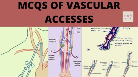Mcqs Of Vascular Access/Types Of Vascular Access For Hemodialysis ... in Beyond the Basics Understanding the AVF Varano's Features