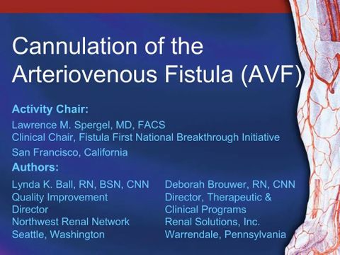Ppt - Cannulation Of The Arteriovenous Fistula Avf Powerpoint ... inside