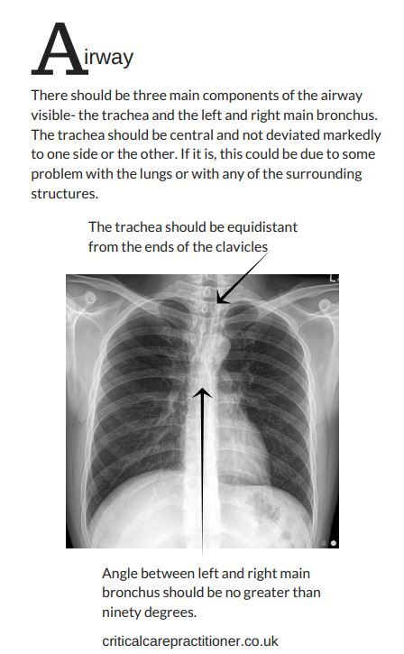 Critical Care Practitioner As I Learn, You Learn Too in Conley Chest What Every Practitioner Needs to Know